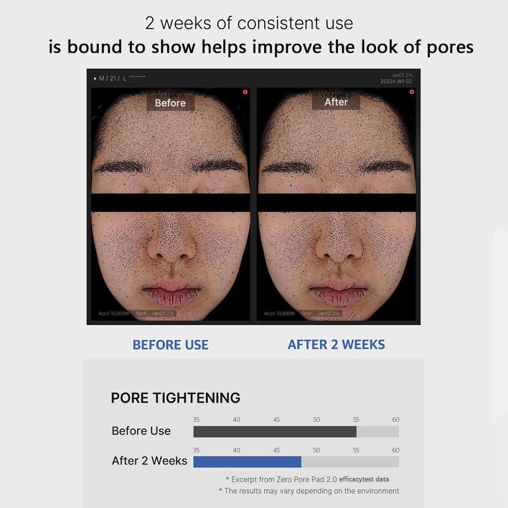 Medicube Zero Pore Pad