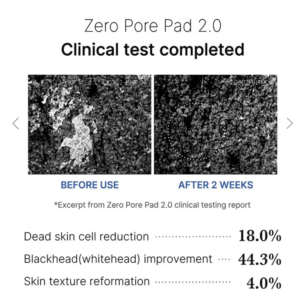 Medicube Zero Pore Pad